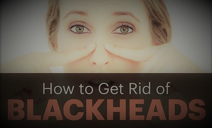 How to get rid of blackheads